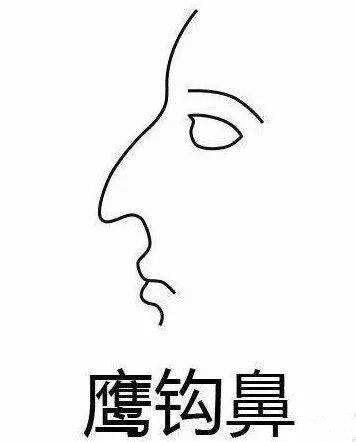 鹰钩鼻整形的魅力与探索