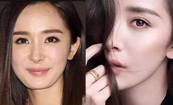 韩式整容，探索美丽的新境界