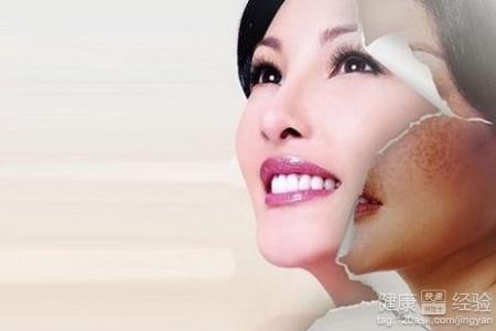 揭秘E光祛斑价格，多少钱让你拥有无瑕肌肤？