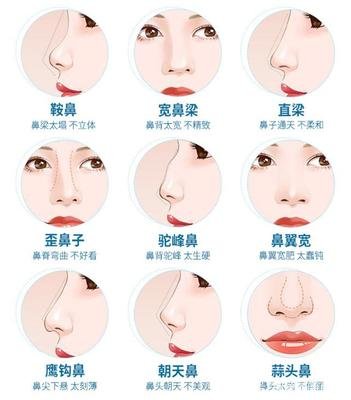 硅胶隆鼻的价格因素与费用概述