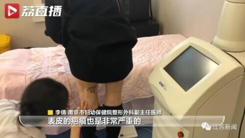 全面解析，吸脂手术费用及其相关因素