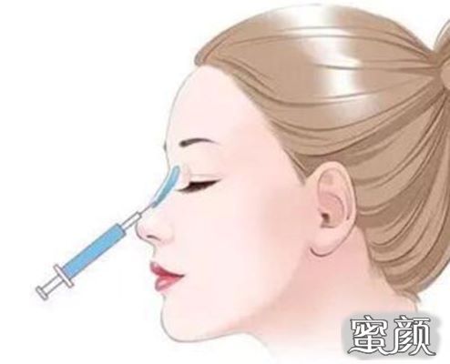 玻尿酸隆鼻，重塑美丽鼻梁的新选择