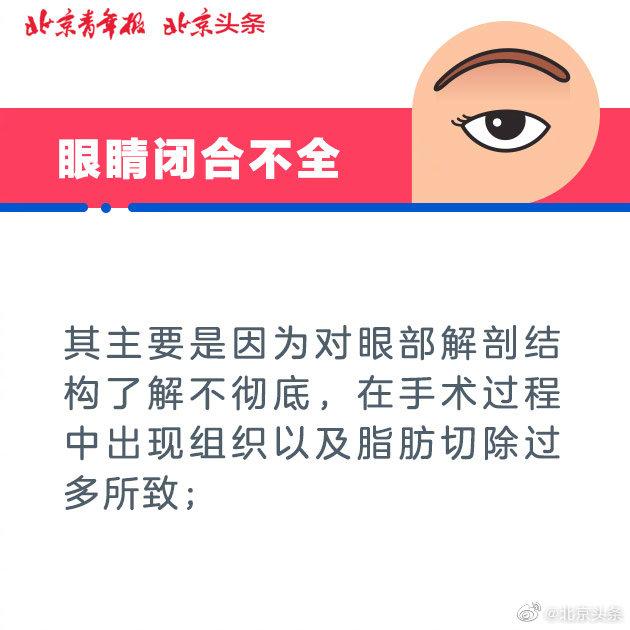 双眼皮手术