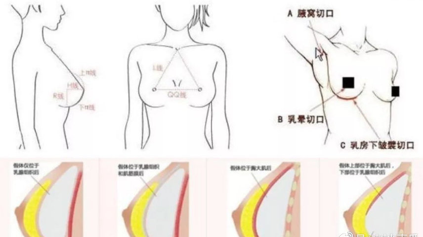 费用概述