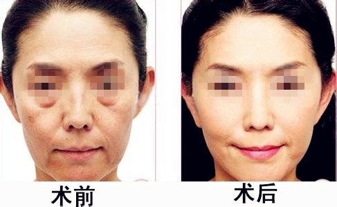 美丽转变