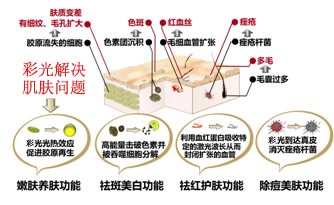 费用因素与选择策略