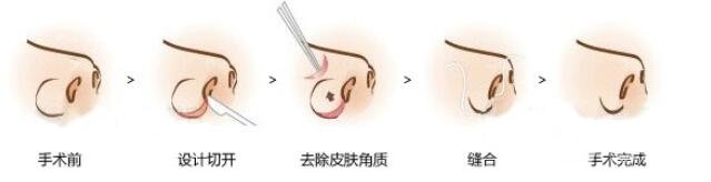 相关因素探讨