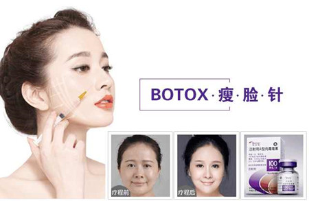 Botox注射瘦脸，价格因素详解